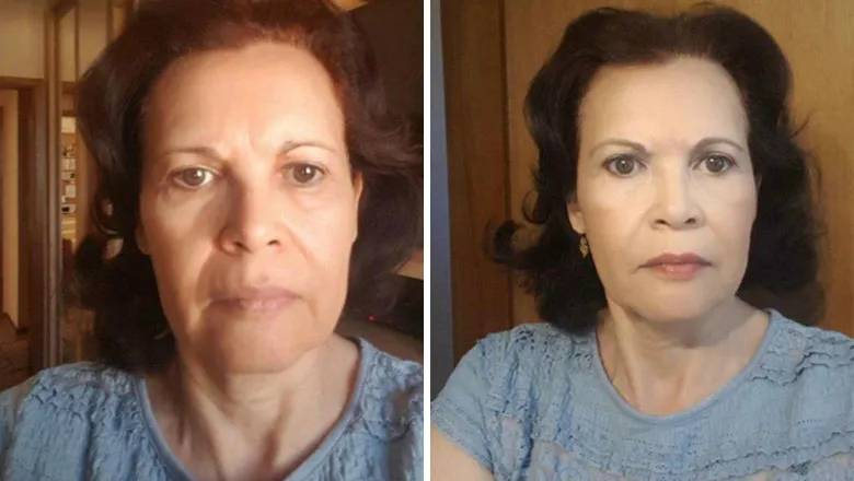 Antes e Depois 2 